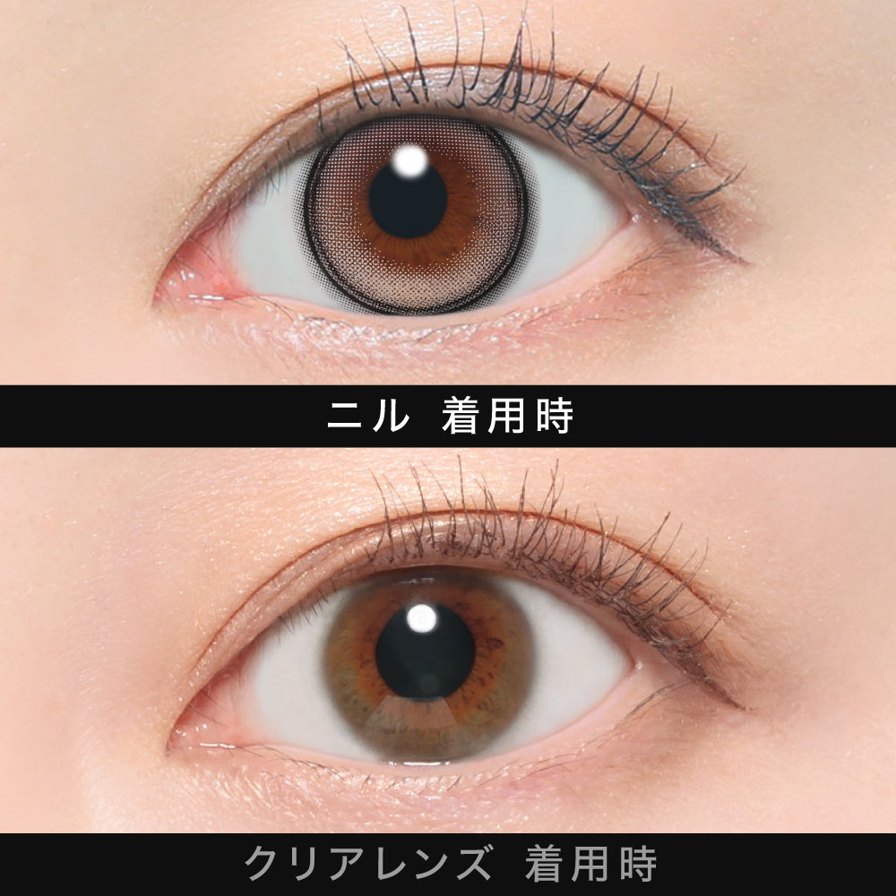 NILL [ØTHER] | 1day 